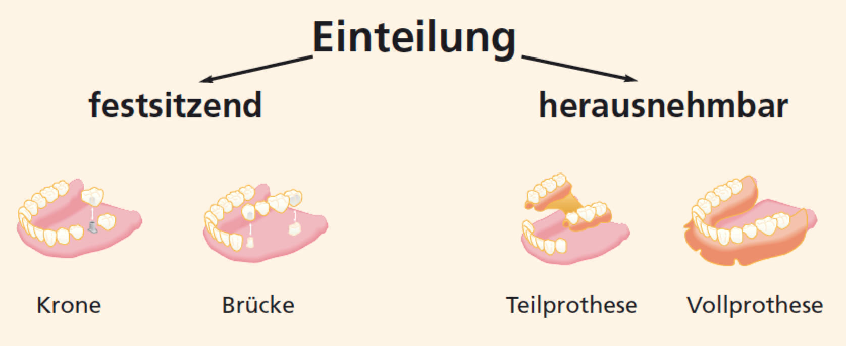 Zahnaersatz: herausnehmbar oder festsitzend?